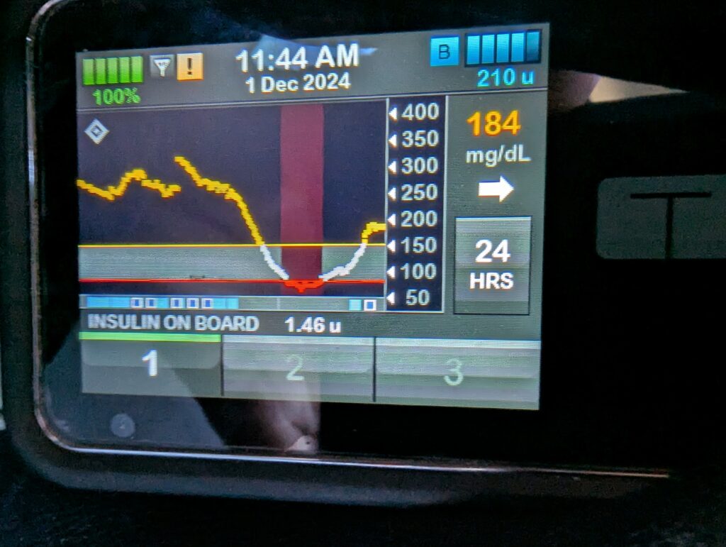 24 hour blood sugar graph from tslim